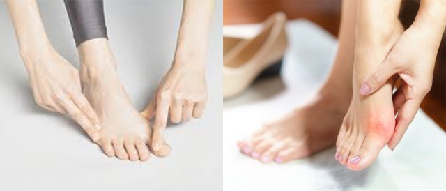 Morphologie de vos pieds